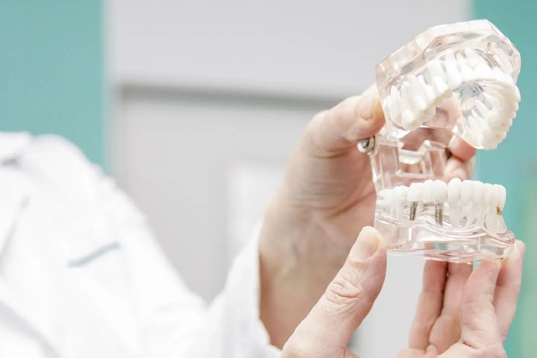 Clinician holding a clear model showing an implant retained denture